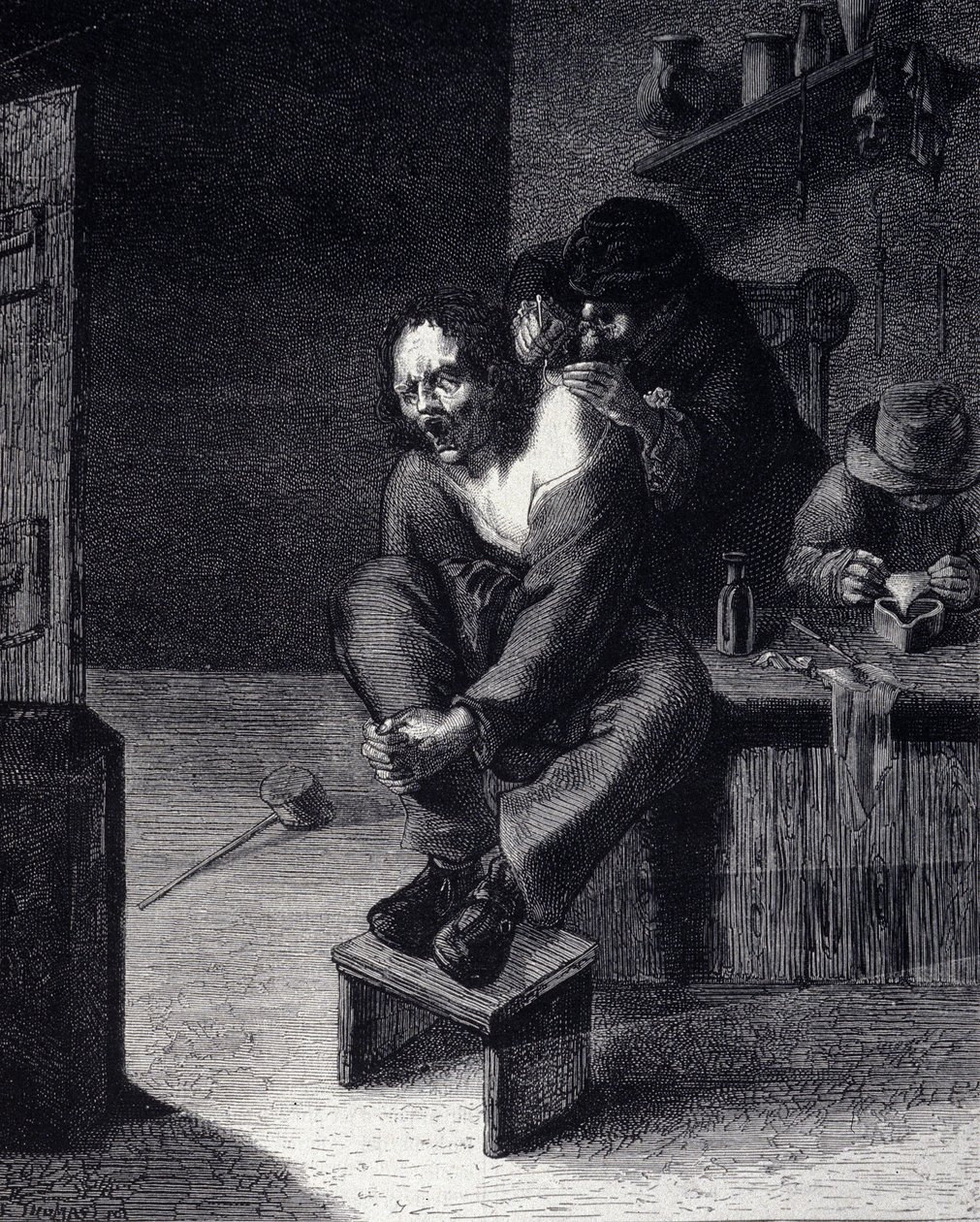 العملية الجراحية النقش بعد لوحة رسمها أدريان براور (فعل 1608) في القرن السابع عشر بواسطة أدريان (بعد) بروير