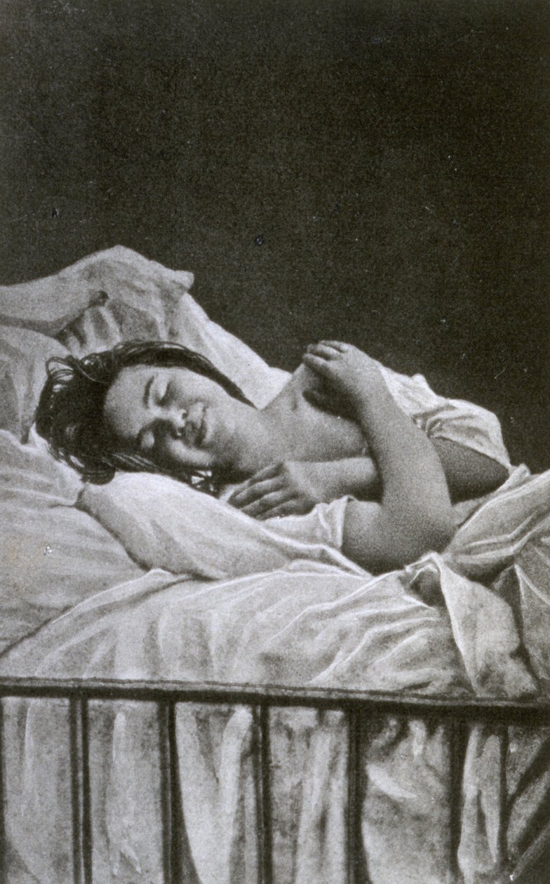 امرأة شابة لديها نوبة هستيريا ، 1878 بواسطة ألبرت لوند