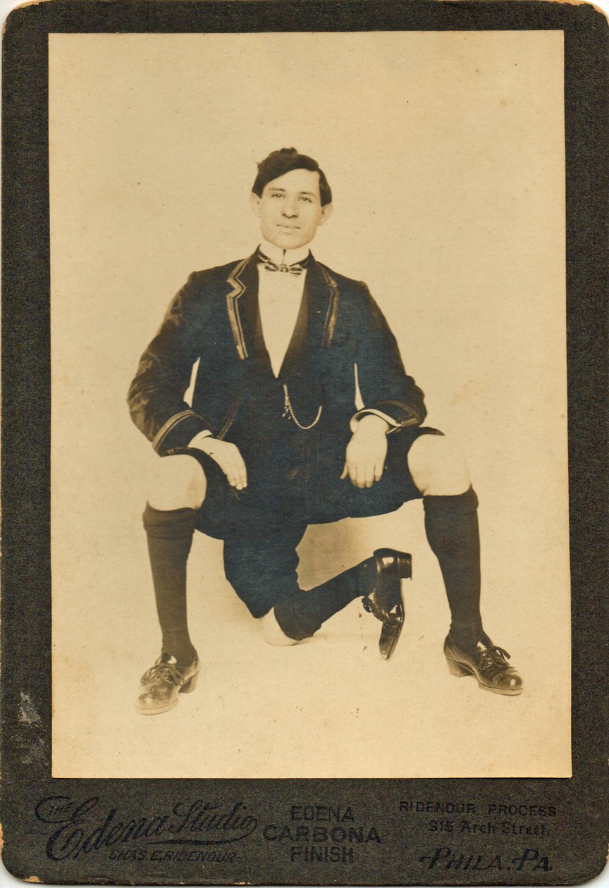 صورة فرانشيسكو لينتيني (1881-1966) ، الرجل ذو الثلاثة أرجل بواسطة مصور أمريكي