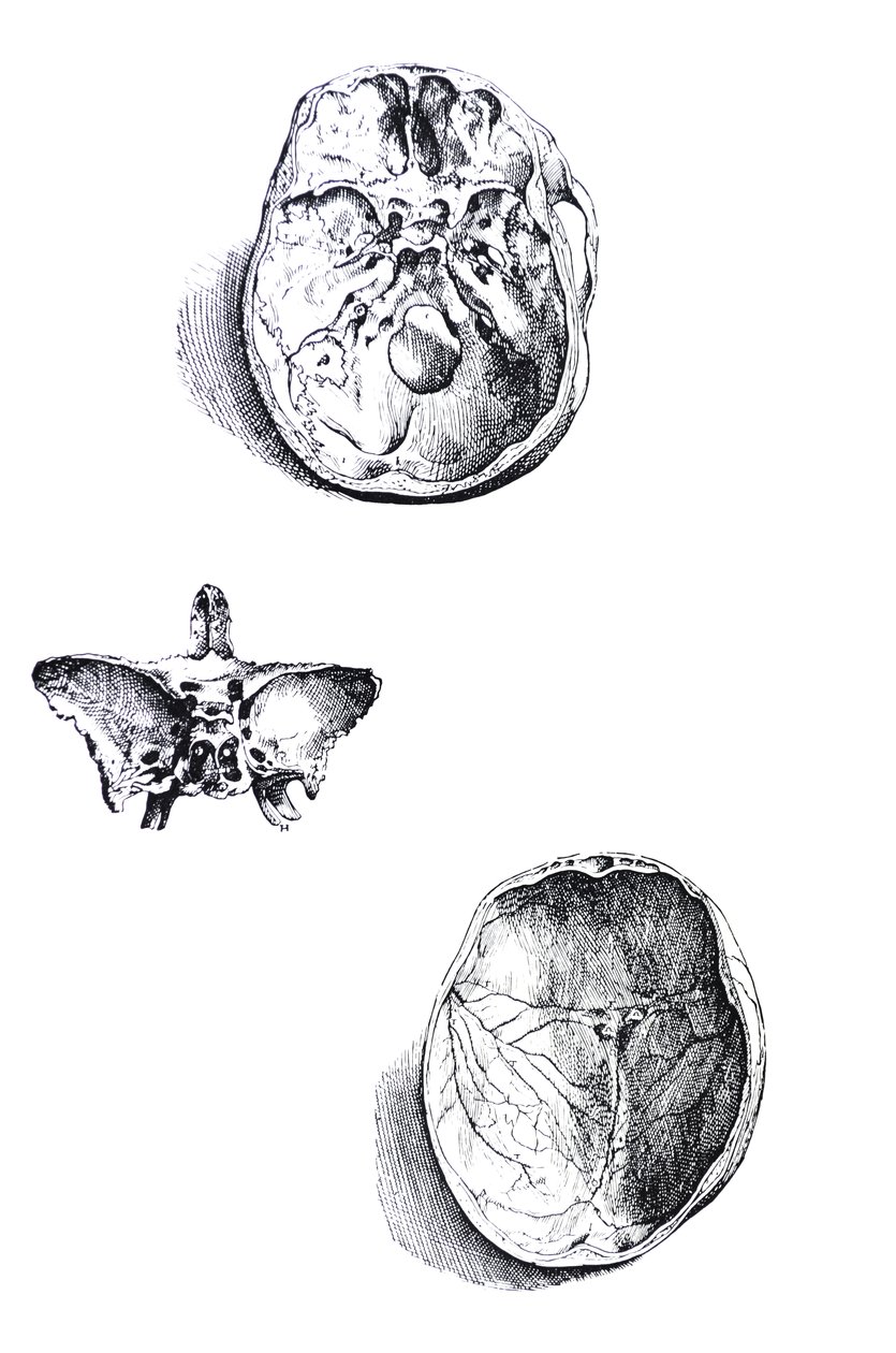 لوحات من الكتاب الأول من De Humani Corporis Fabrica بواسطة أندرو فيزاليوس