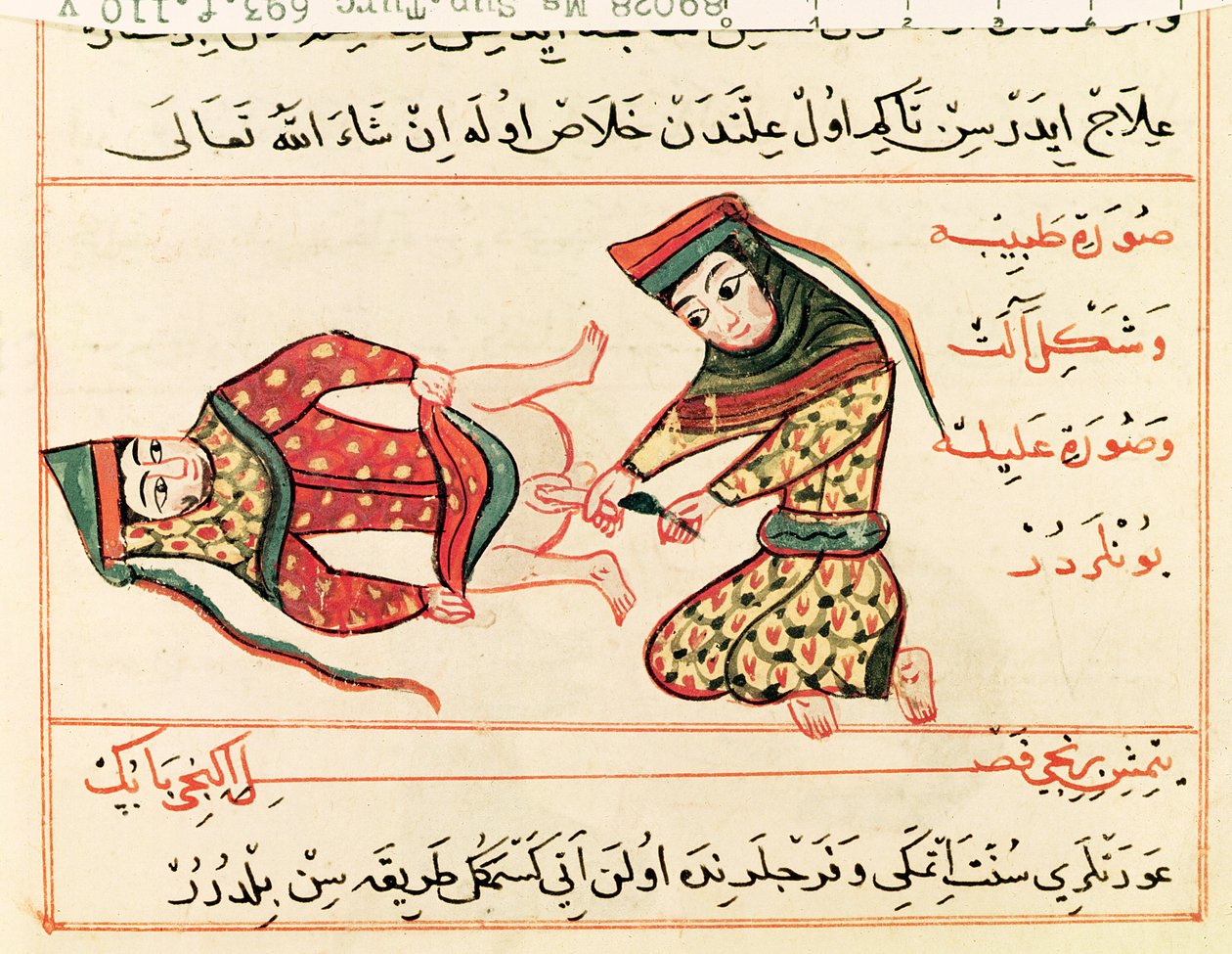 السيدة Sup Turc 693 fol.110v القابلة تعمل على خنثي ، 1466 بواسطة شرف الدين