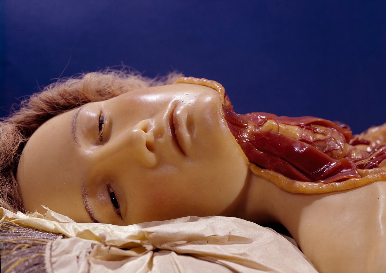 نموذج لرجل تم قطع حلقه (شمع) بواسطة كليمنتي سوسيني