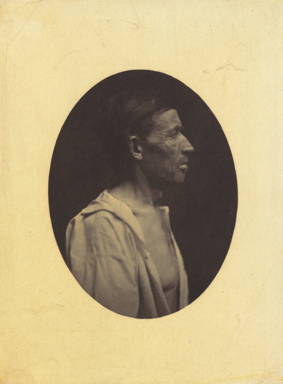 صورة شخصية لرجل يبلغ من العمر 42 عامًا ، أذهله تعاطي الكحول ... 1854-1856. بواسطة دوشين دي بولوني