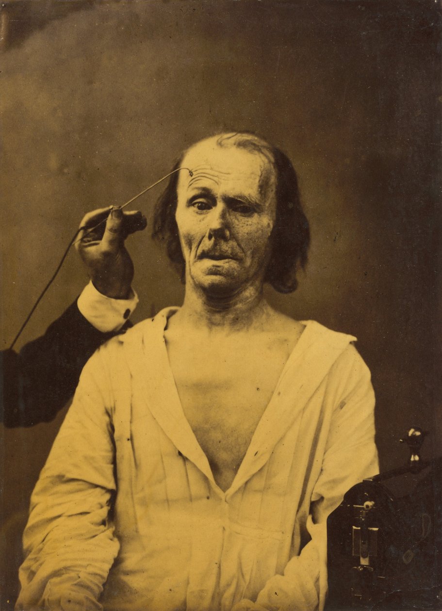 وجه مسترخي يسار ، انتباه عميق يمين ، 1854-1856 ، مطبوع عام 1862. بواسطة دوشين دي بولوني