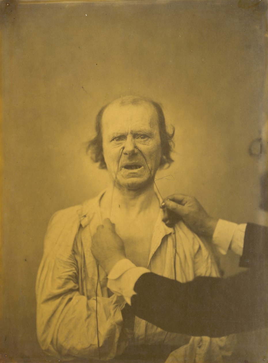 السخط ، الفكاهة السيئة ، 1854-1856 ، طبعت عام 1862. بواسطة دوشين دي بولوني