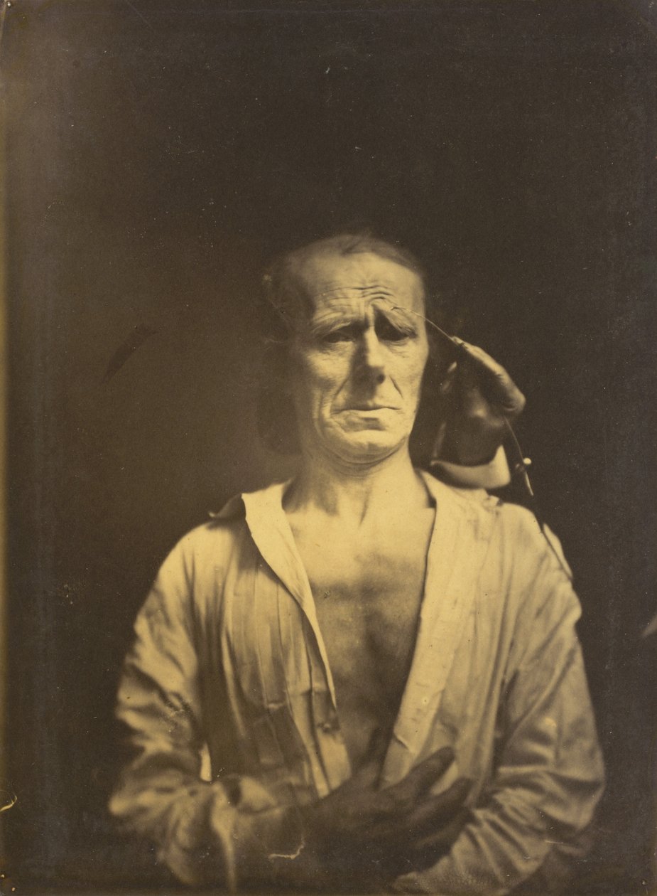 تشنج م. مموج supercilii تحت ضوء قوي جدًا يسار ، وجه مسترخي ... ، 1854-1855. بواسطة دوشين دي بولوني