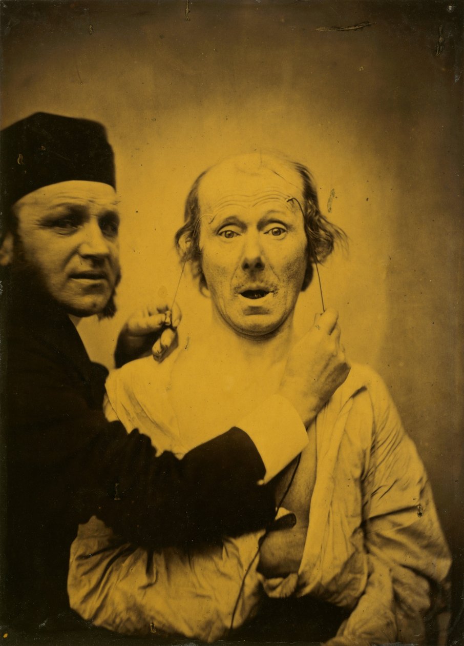 مفاجأة ، 1854-1855 ، مطبوعة عام 1862. بواسطة دوشين دي بولوني