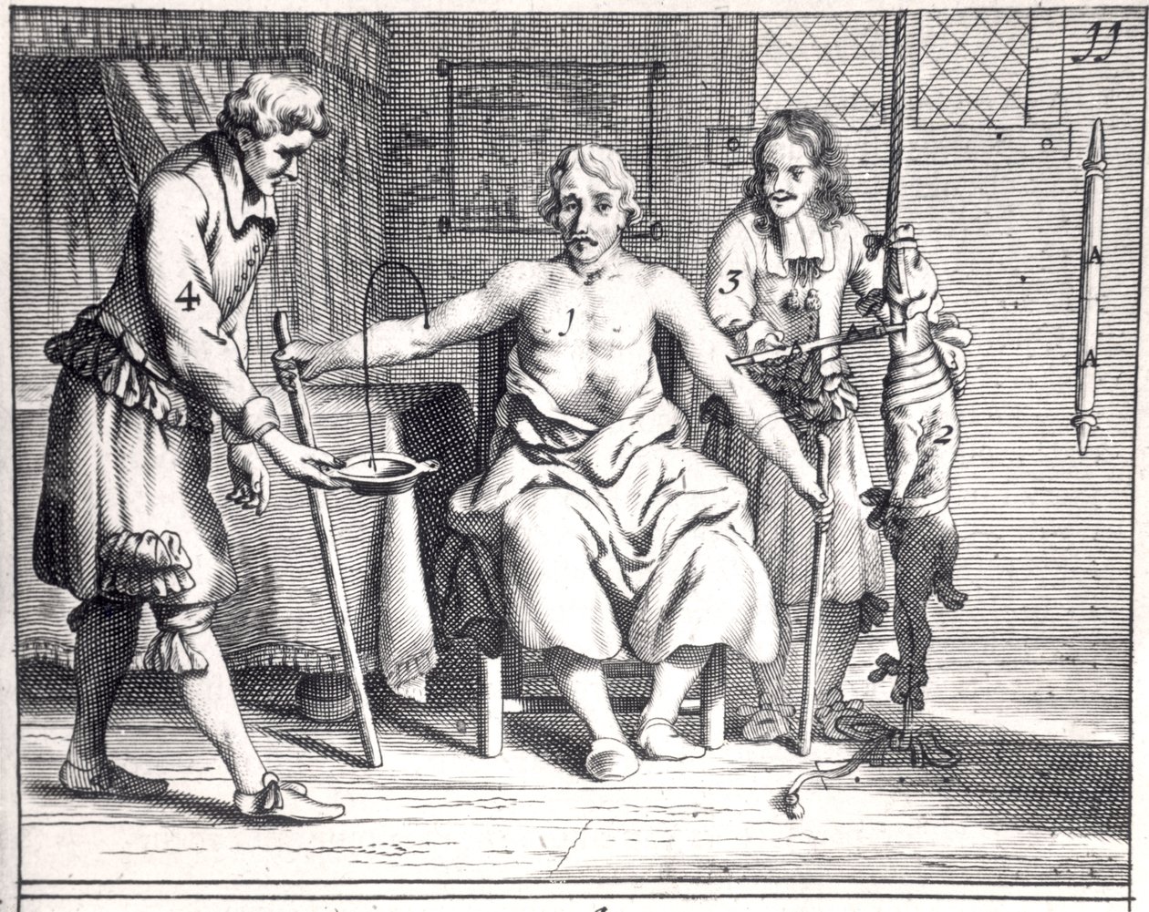 نقل الدم من كلب ، من Armamentarii Chirurgici بقلم يوهانس شولتس (1595-1645) المنشور في أمستردام ، 1671 بواسطة المدرسة الهولندية