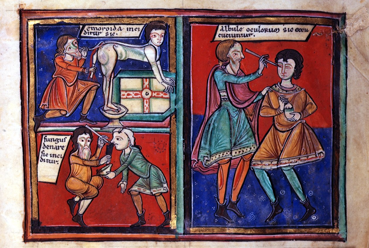 Sloane Ms 1975 fol.93 العمليات الطبية بواسطة مدرسة اللغة الإنجليزية