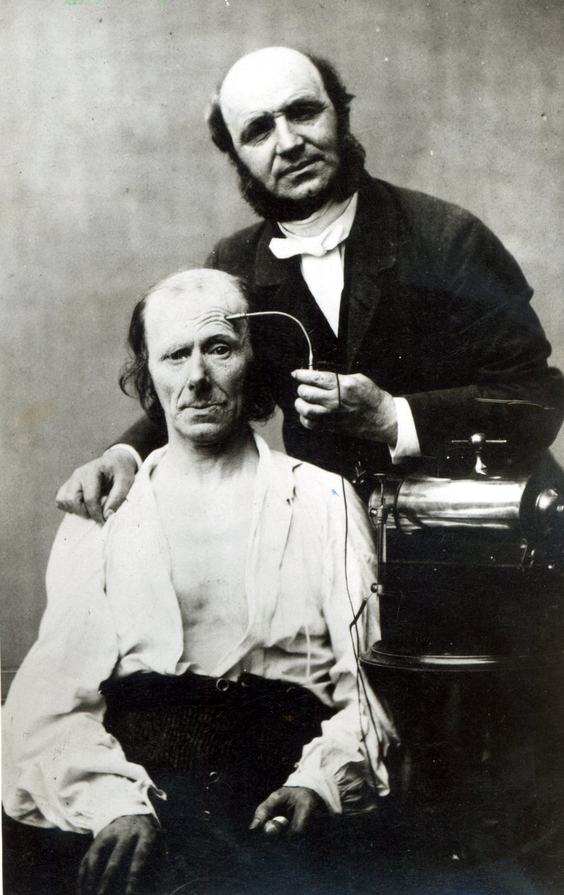 Duchenne de Boulogne مع مريض ضحية ، 1862 بواسطة مصور فرنسي