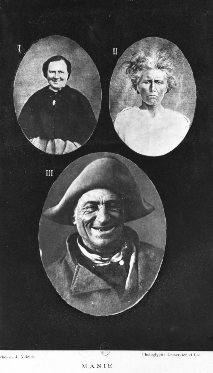 الهوس ، توضيح من العلاج الأولي والعملي الجديد للأمراض العقلية بواسطة هنري داجونيت (1823-1902) باريس ، بايلير ، 1876 بواسطة مصور فرنسي