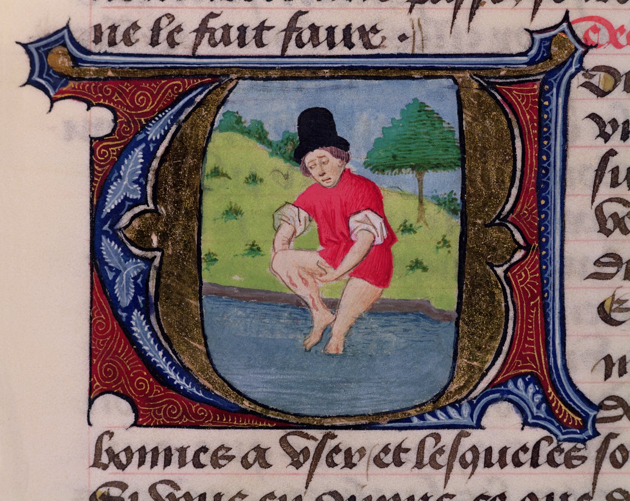 F.27v Leeching ، من Traite de Medecine بواسطة Aldebrande de Florence ، 1356 بواسطة المدرسة الفرنسية