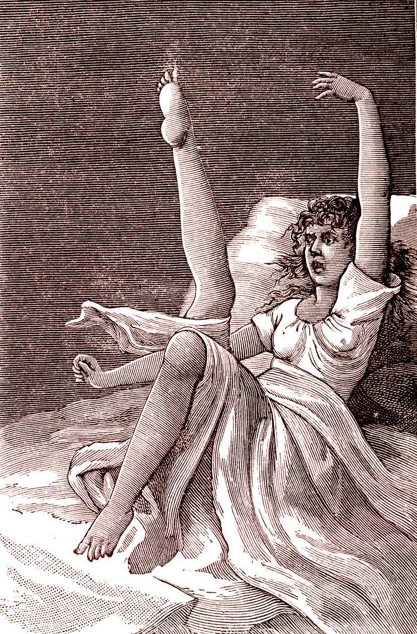الهستيريا، وهي ظاهرة عقلية للغاية، والذهان والعصاب النفسي. 1887 (نقش) بواسطة المدرسة الفرنسية