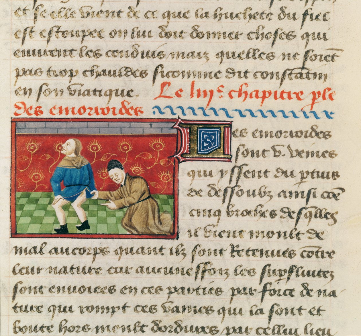 السيدة 22532 فحص مريض بالبواسير ، من Le Livre des Proprietes des choses بواسطة Barthelemy lAnglais ، c. 1410-15 بواسطة المدرسة الفرنسية