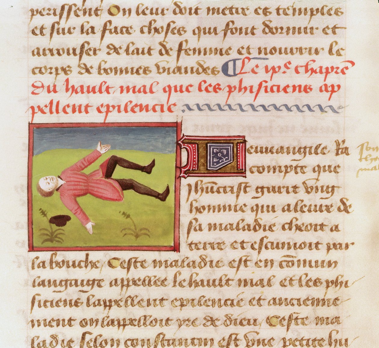 السيدة 22532 مريض يعاني من نوبة صرع ، من Le Livre des Proprietes des choses بواسطة Barthelemy lAnglais ، c. 1410-15 بواسطة المدرسة الفرنسية