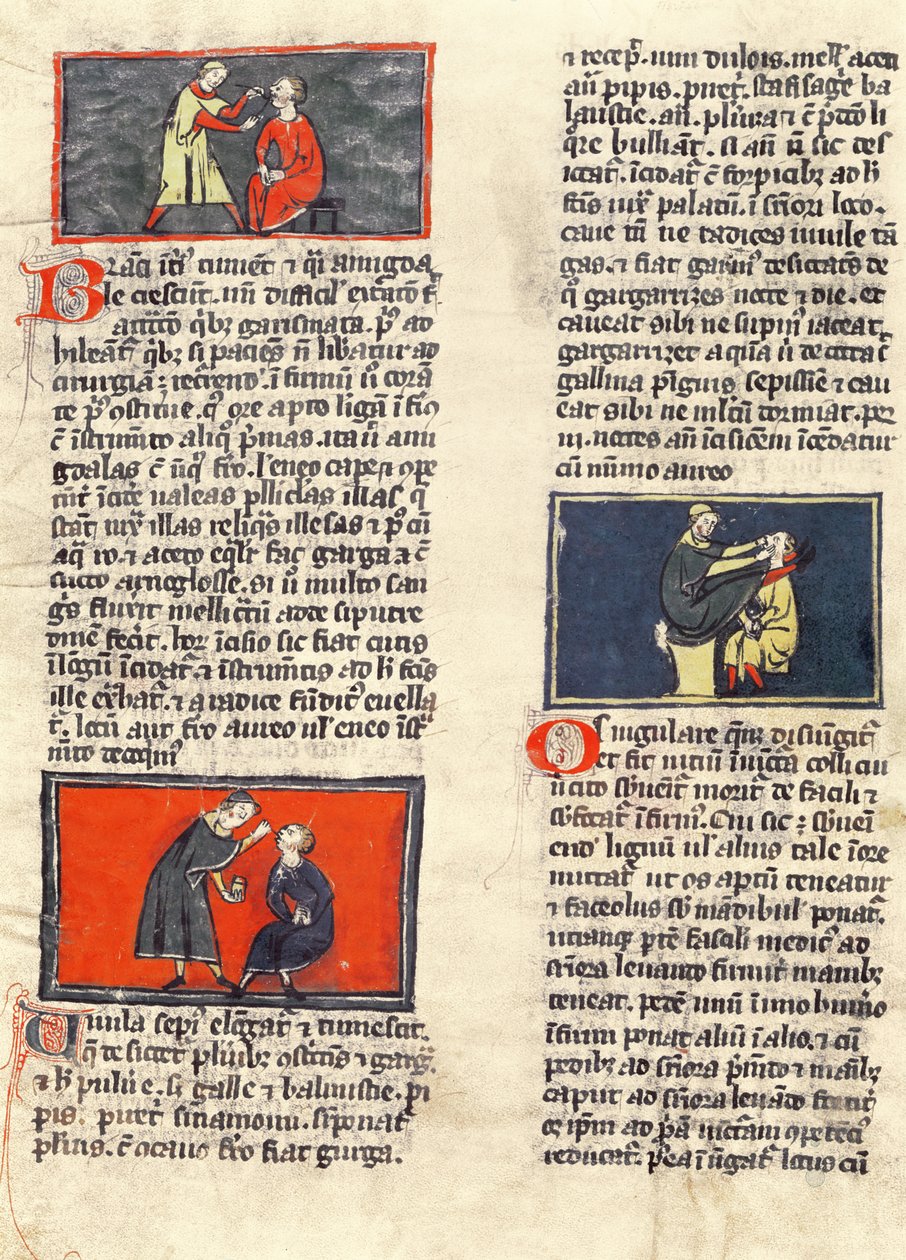 السيدة H 89 fol.16v جراحة الأسنان ، من طبعة من "كتاب الجراحة" بقلم روجير دي ساليرن بواسطة المدرسة الفرنسية