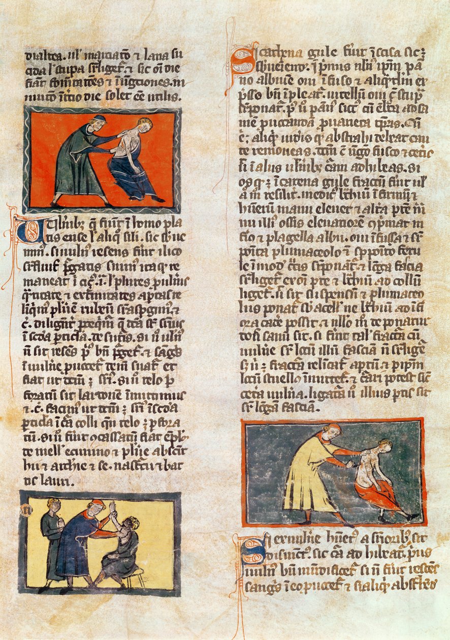 السيدة H 89 fol.17r الجراحة ، من طبعة من "كتاب الجراحة" بقلم روجير دي ساليرن بواسطة المدرسة الفرنسية