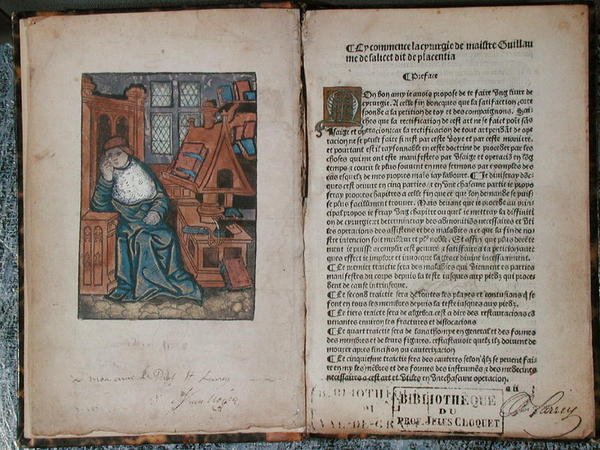 صفحة من "La Cyrurgie de Maistre Guillaume de Salicet" ، باريس بواسطة المدرسة الفرنسية