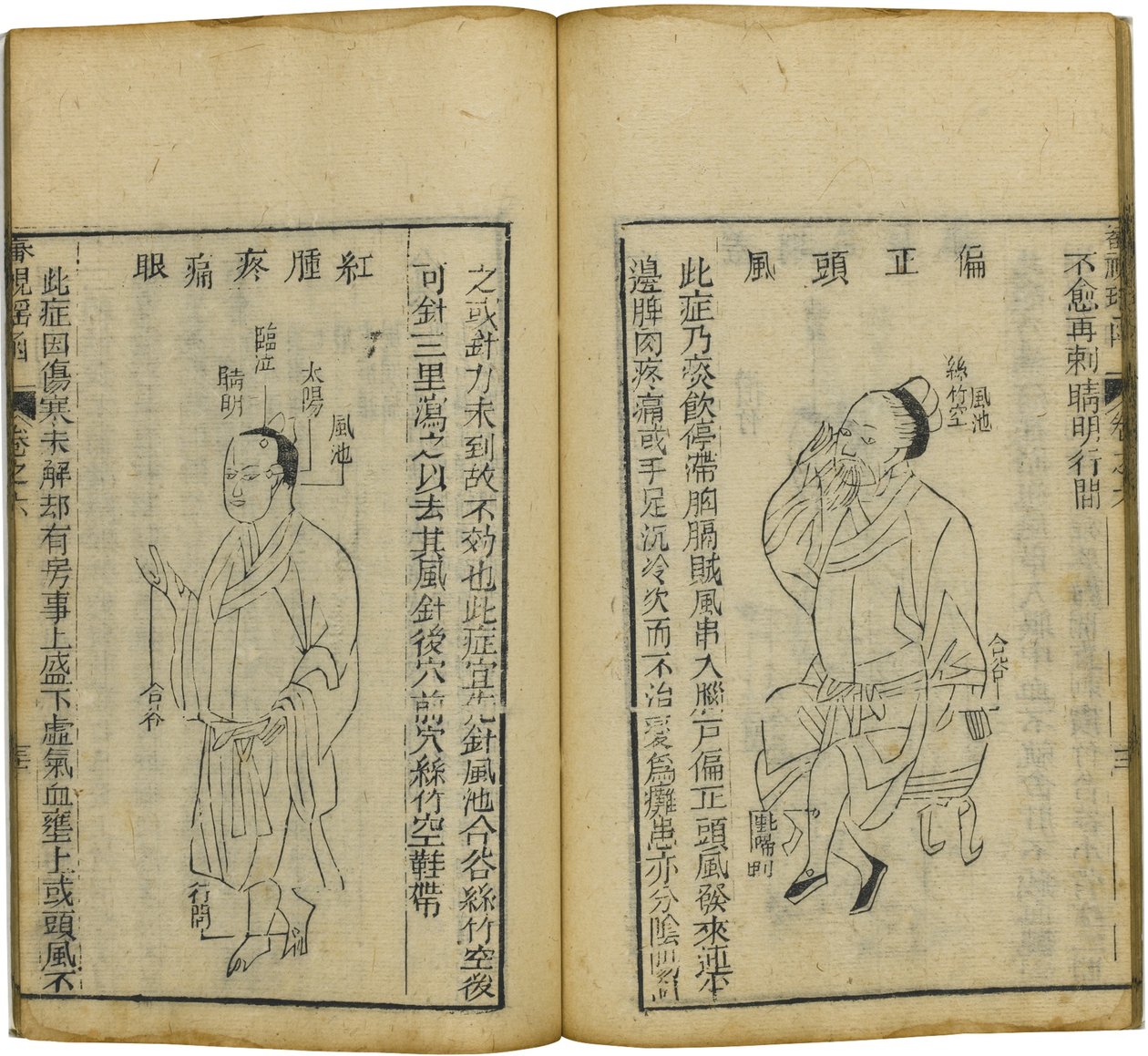 شين شي ياو هان كتاب ثمين لطب العيون ، 1644 بواسطة فو رينيو
