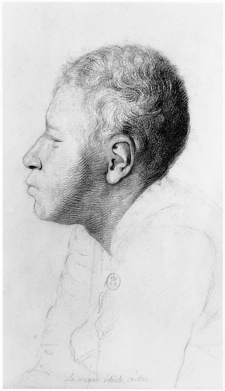 Cretin ، ملف شخصي ، توضيح من مقالة غير منشورة بقلم جان إتيان دومينيك إسكولول (1772-1840) على المجانين من ملجأ Salpetriere ، c.1818 بواسطة جورج فرانسوا جابرييل