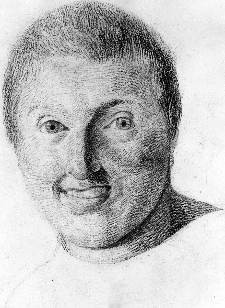 An epileptic, -in “Etude de la physiognomy des alienés”, drawing by Gabriel بواسطة جورج فرانسوا جابرييل