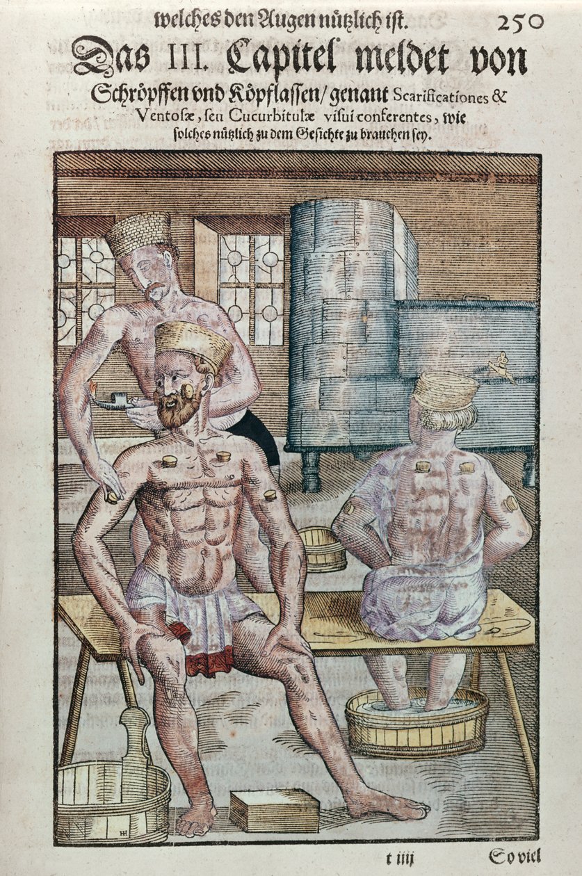 الحجامة ، من Ophthalmodouleia بواسطة جورج بارتيش (1535-1636) المنشورة في دريسدن في 1583 (طباعة لوحة خشبية ملونة) بواسطة المدرسة الألمانية
