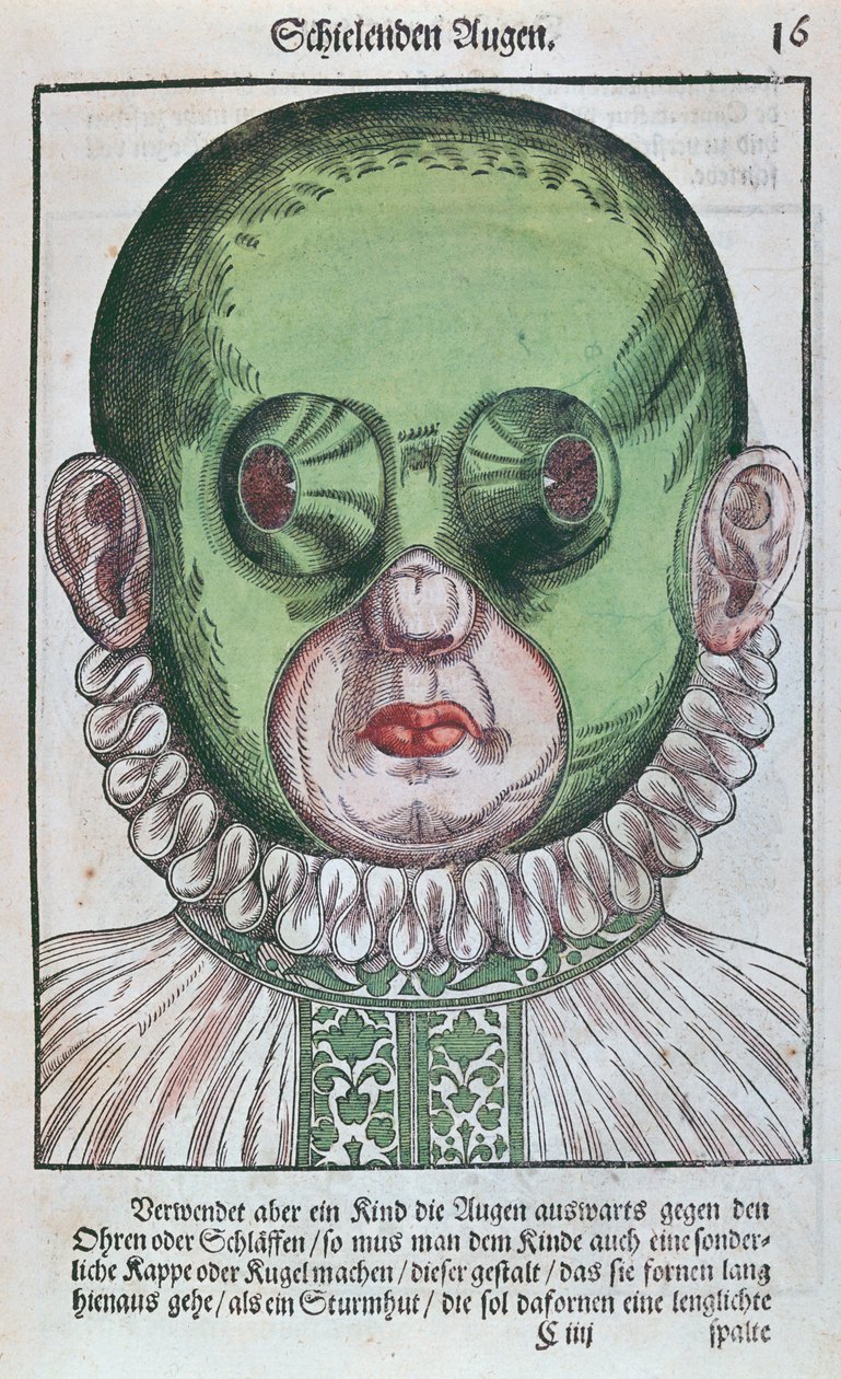 قناع لعلاج الحول ، من Ophthalmodouleia بواسطة جورج بارتيش (1535-1636) نشر في دريسدن عام 1583 (طباعة لوح خشبي ملون) بواسطة المدرسة الألمانية