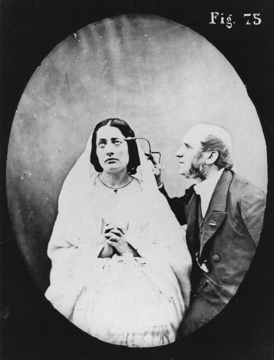 الفحص الفيزيولوجي ، من "Mecanisme de la Physionomie humaine ou تحليل electrophysiologique des loveions" بواسطة Duchenne de Boulogne ، المنشور عام 1876 ، باريس بواسطة Guillaume Benjamin Armand Duchenne de Boulogne