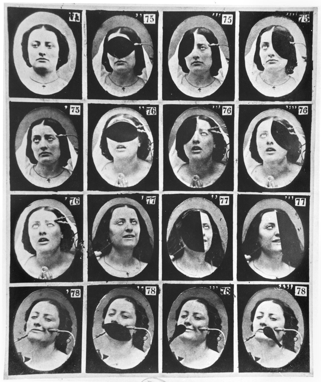 دراسات فسيولوجية ، من &39;Mecanisme de la Physionomie humaine ou تحليل Electrophysiologique des loveions&39; بواسطة Duchenne de Boulogne ، المنشور عام 1876 ، باريس بواسطة Guillaume Benjamin Armand Duchenne de Boulogne