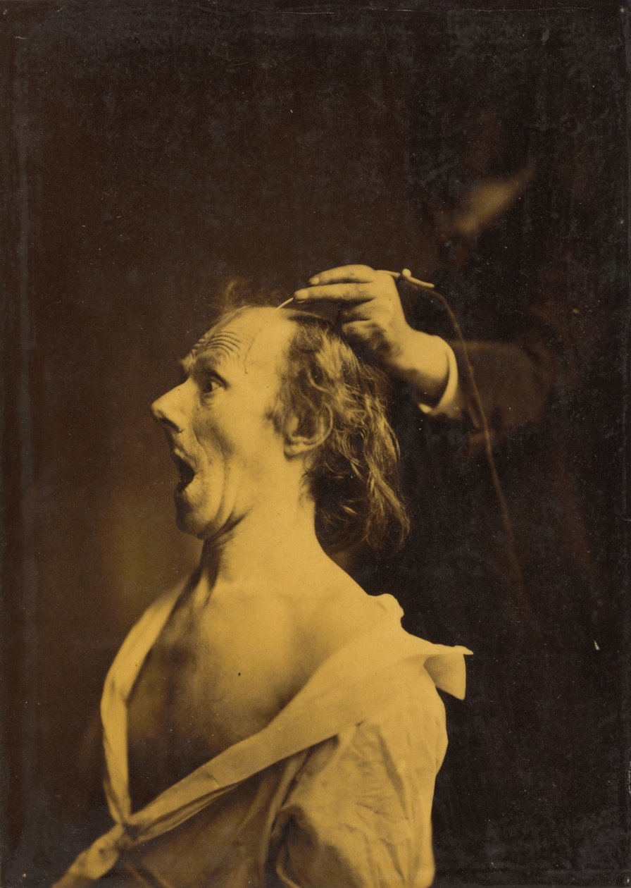 بواسطة Guillaume Benjamin Armand Duchenne de Boulogne