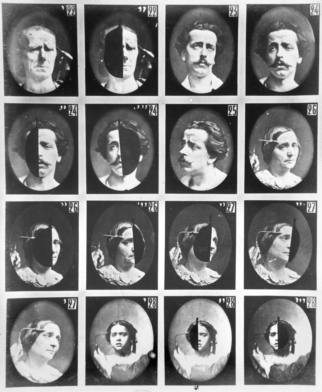 دراسات فسيولوجية من 22 إلى 28 ، من "Mecanisme de la Physionomie Humaine ou تحليل Electrophysiologique des loveions" بواسطة Duchenne de Boulogne ، نُشر عام 1876 ، باريس بواسطة Guillaume Benjamin Armand Duchenne de Boulogne