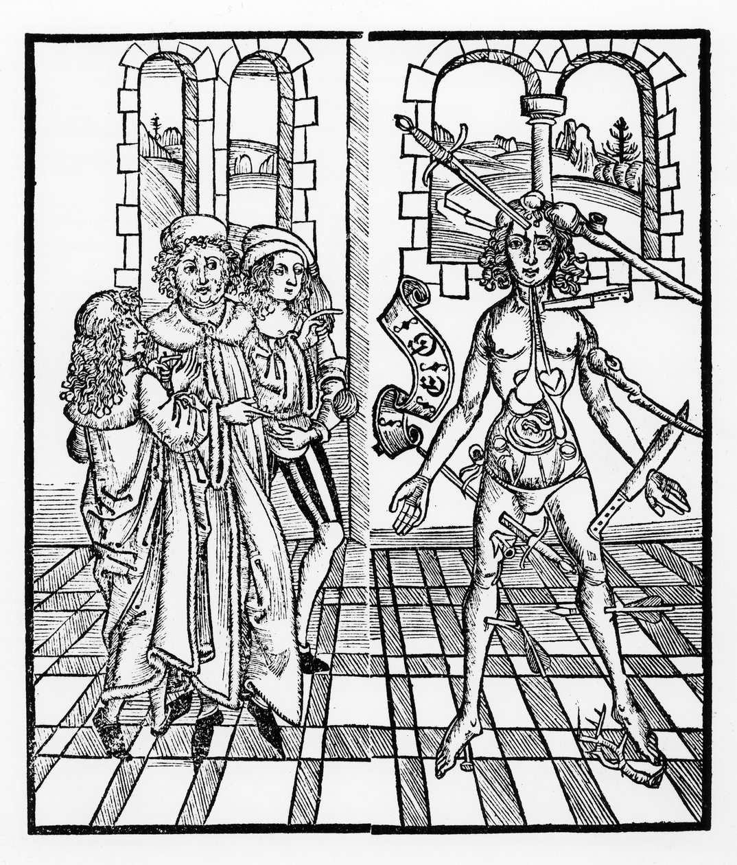 الرجل الجريح ، من Das Buch der Cirugia نشر ستراسبورغ ، 1497 بواسطة هيرونيموس برونشويغ