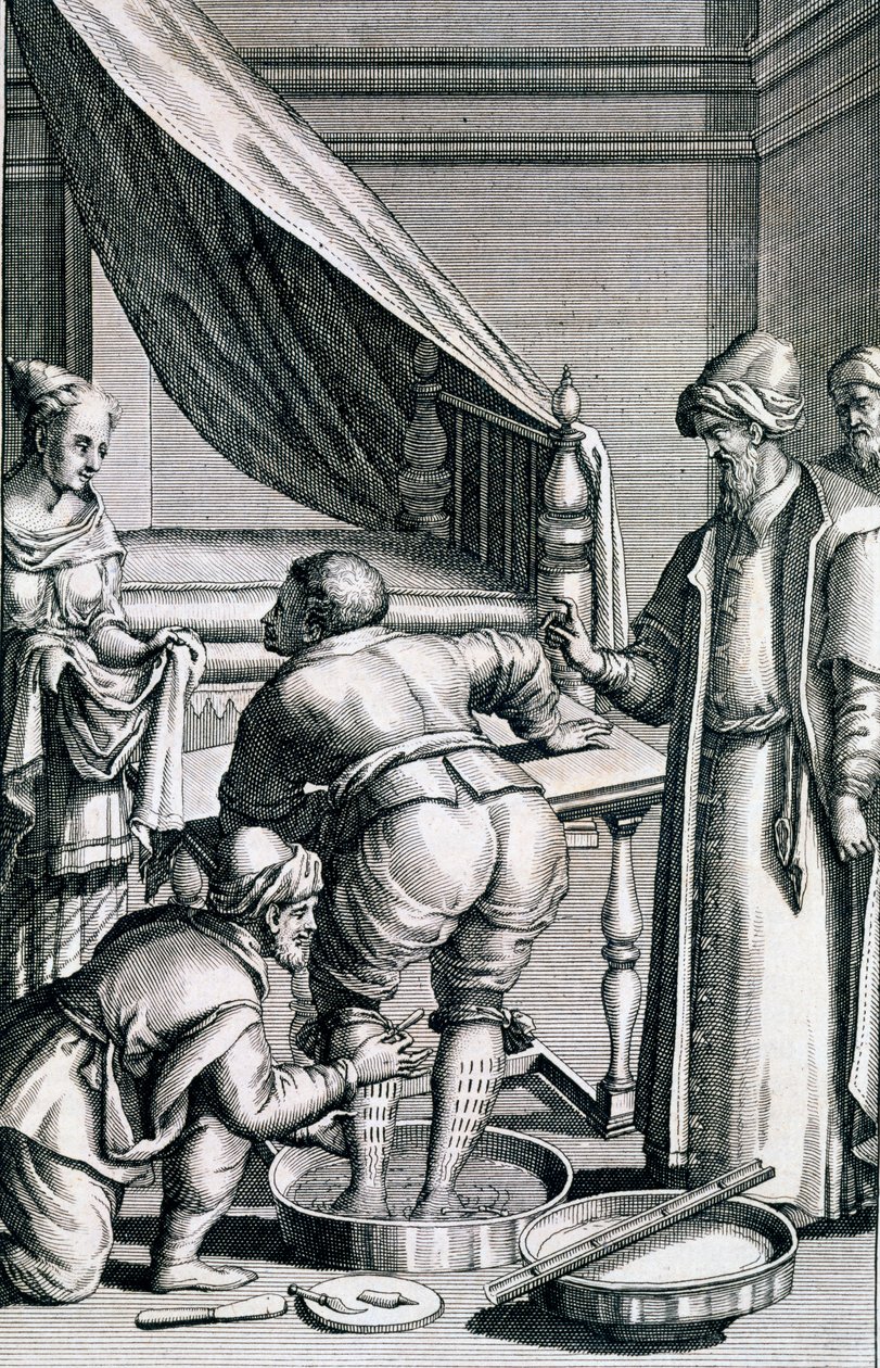 سفك الدماء في الساقين ، من Medicina Aegyptiorum بواسطة Prospero Alpini ، نشر 1745 بواسطة المدرسة الايطالية
