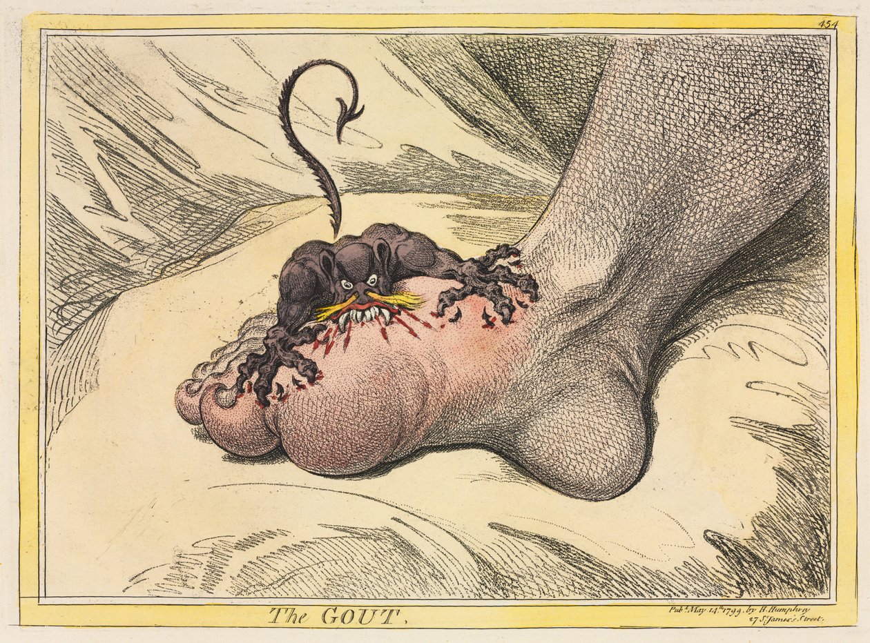 النقرس ، 1799. بواسطة جيمس جيلراي