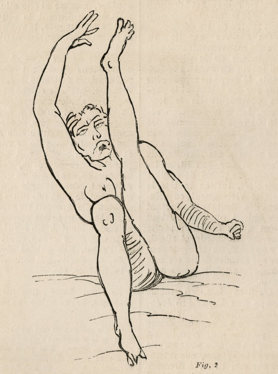 الصرع الهستيري ، الهجوم ، الالتواءات ، التين. 2 من "Iconographie Photographique de La Salpetriere" بقلم بورنفيل و ب. ريجنارد ، باريس ، 1876 بواسطة جان فرانسوا بادورو