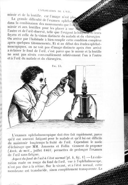 رسم توضيحي من "Traite Pratique des Maladies des Yeux" ، ترجمة "دليل مبادئ وممارسات طب وجراحة العيون" ، توماس وارتون جونز (1808-1991) بقلم إي فوشير ، نُشر في باريس 1862 (نقش) (ب / ث صور) بواسطة جان فرانسوا بادورو