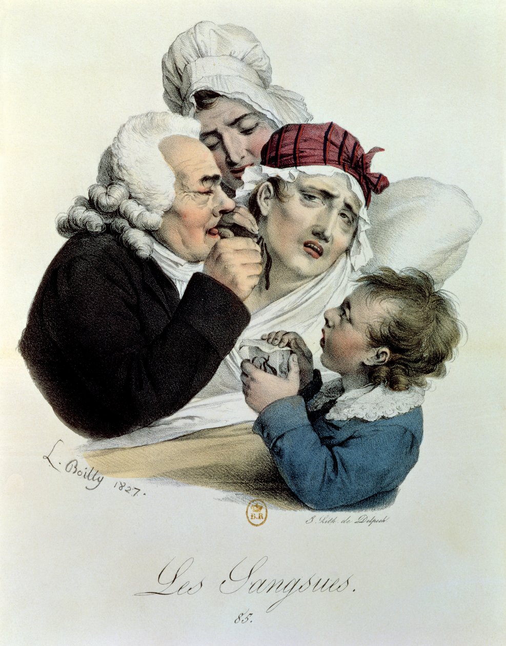 العلق ، محفورة بواسطة Delpech ، 1827 بواسطة جوليان ليوبولد بويلي