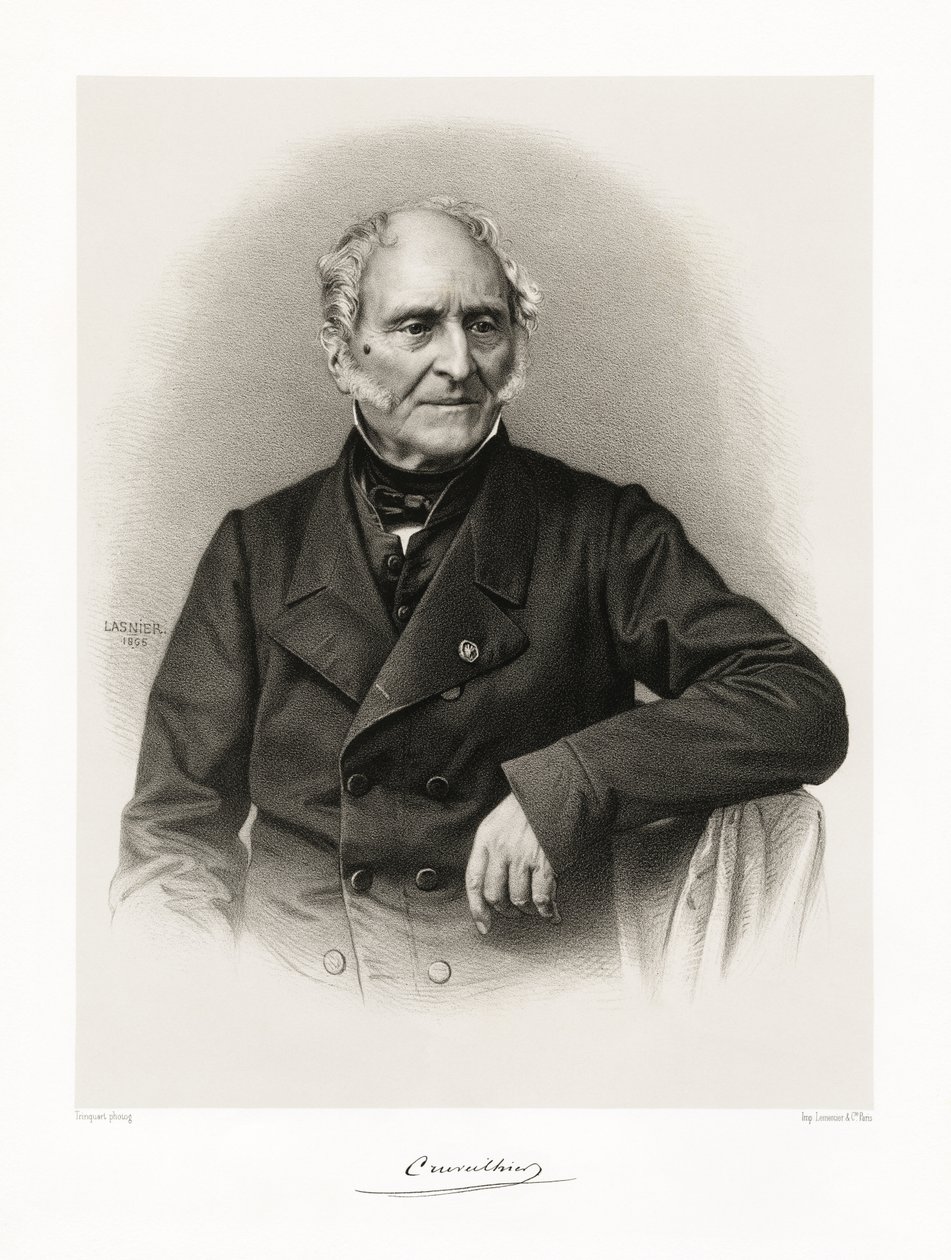 جان كروفيلهير ، 1865-66 بواسطة Lasnier