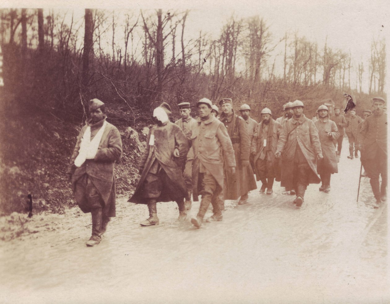 February 1917 - Verdun-Front French prisoners wounded escorted back by German soldiers بواسطة غير معروف غير معروف