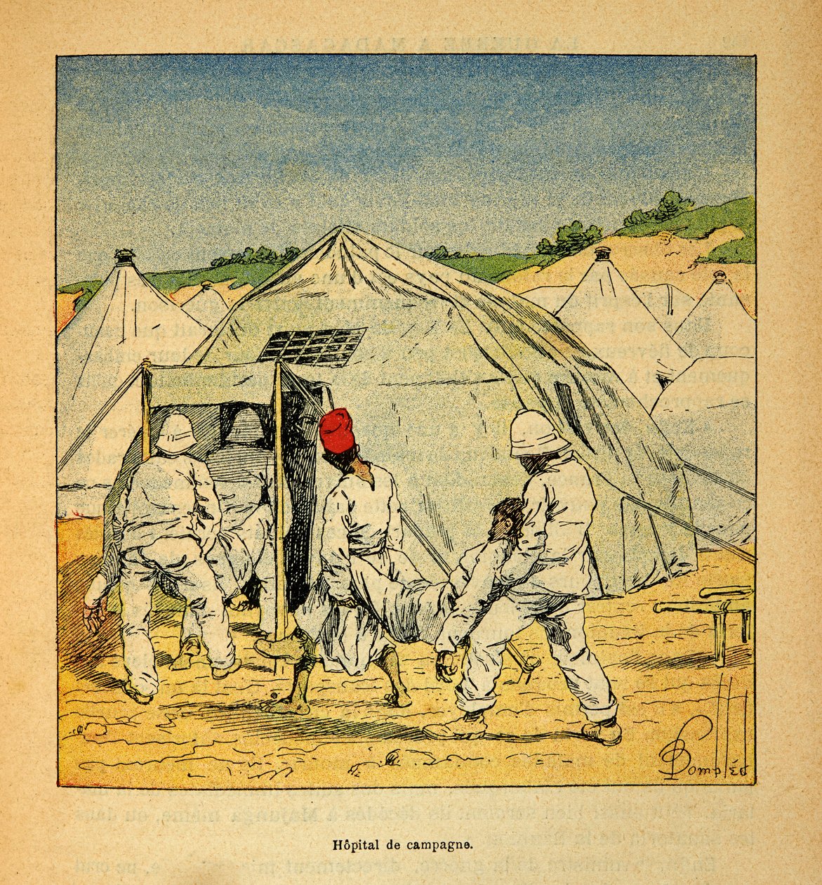 الحرب في مدغشقر - التاريخ القصصي للبعثات الفرنسية 1885-1895 بقلم هنري جالي ديت جاليشيت (1854-1922) ، رسمها لويس بومبلد (1862-1927): المستشفى العسكري الميداني في مدغشقر في عام 1895 ، مجموعة خاصة بواسطة تفجير لويس تشارلز