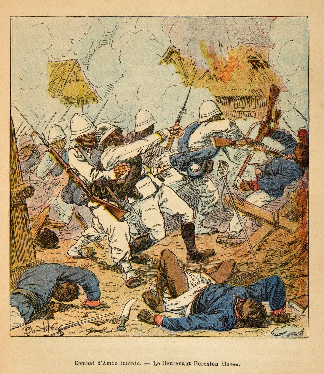 الحرب في مدغشقر - التاريخ القصصي للبعثات الفرنسية 1885-1895 بواسطة هنري جالي ديت غالليشيت (1854-1922) ، مصور من قبل لويس بومبلد (1862-1927): جروح الملازم فورستون أثناء معارك أمبولومونتي في عام 1895 ، مجموعة خاصة بواسطة تفجير لويس تشارلز