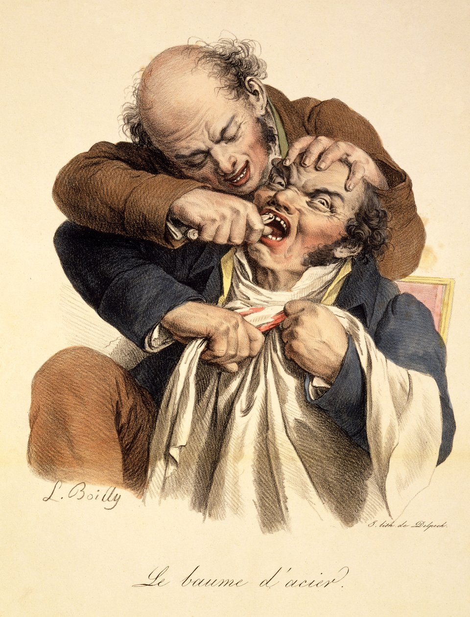 بلسم الفولاذ - سحب الأسنان ، حانة. في باريس ، 1826 بواسطة لويس ليوبولد بويلي