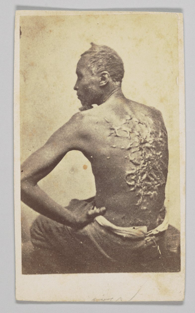 جوردون تحت الفحص الطبي ، 1863. بواسطة ماكفرسون وأوليفر