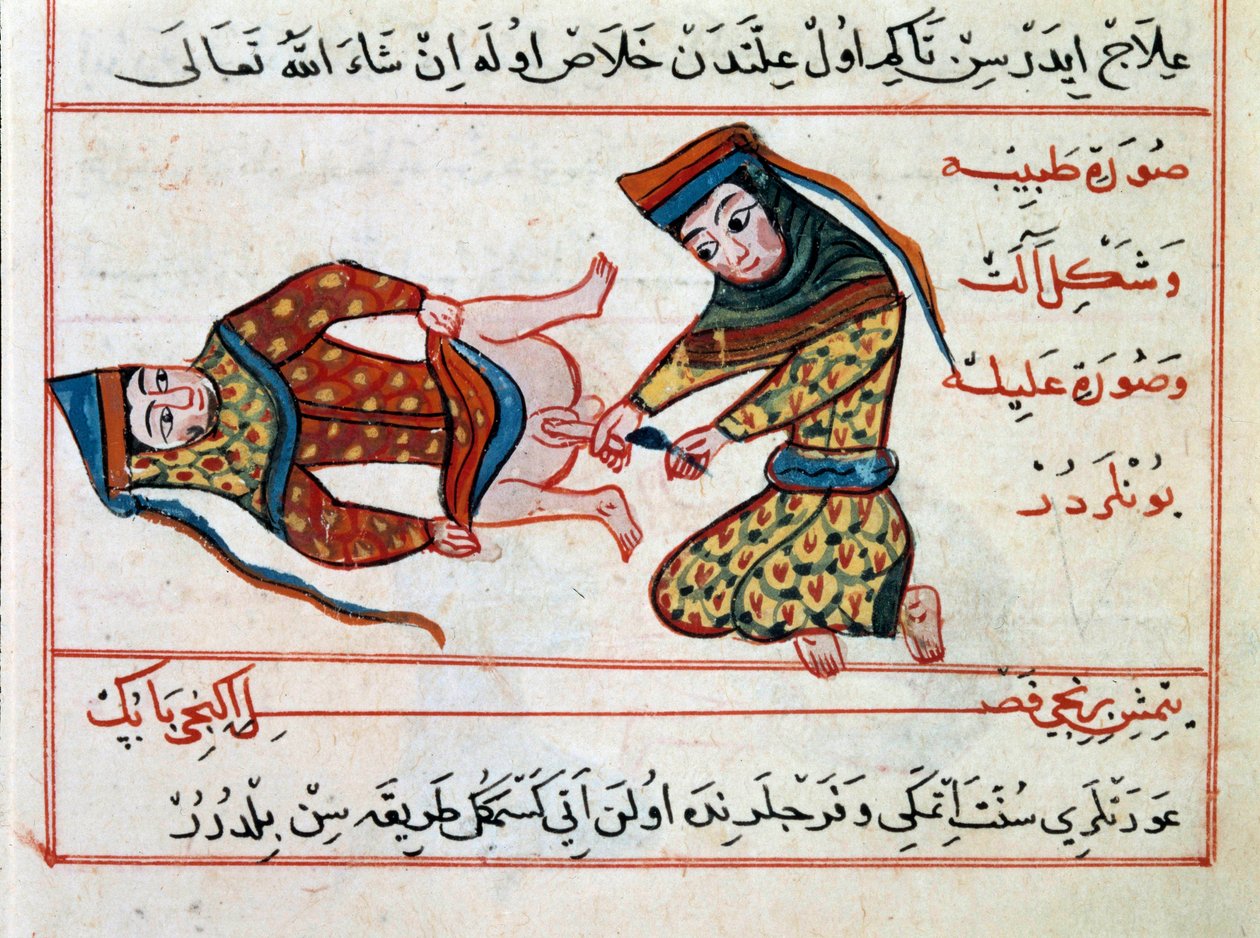 الطب: عملية التهاب الخنثى. صورة مصغرة من علاج الطب التركي لشرف الدين بواسطة المدرسة العثمانية
