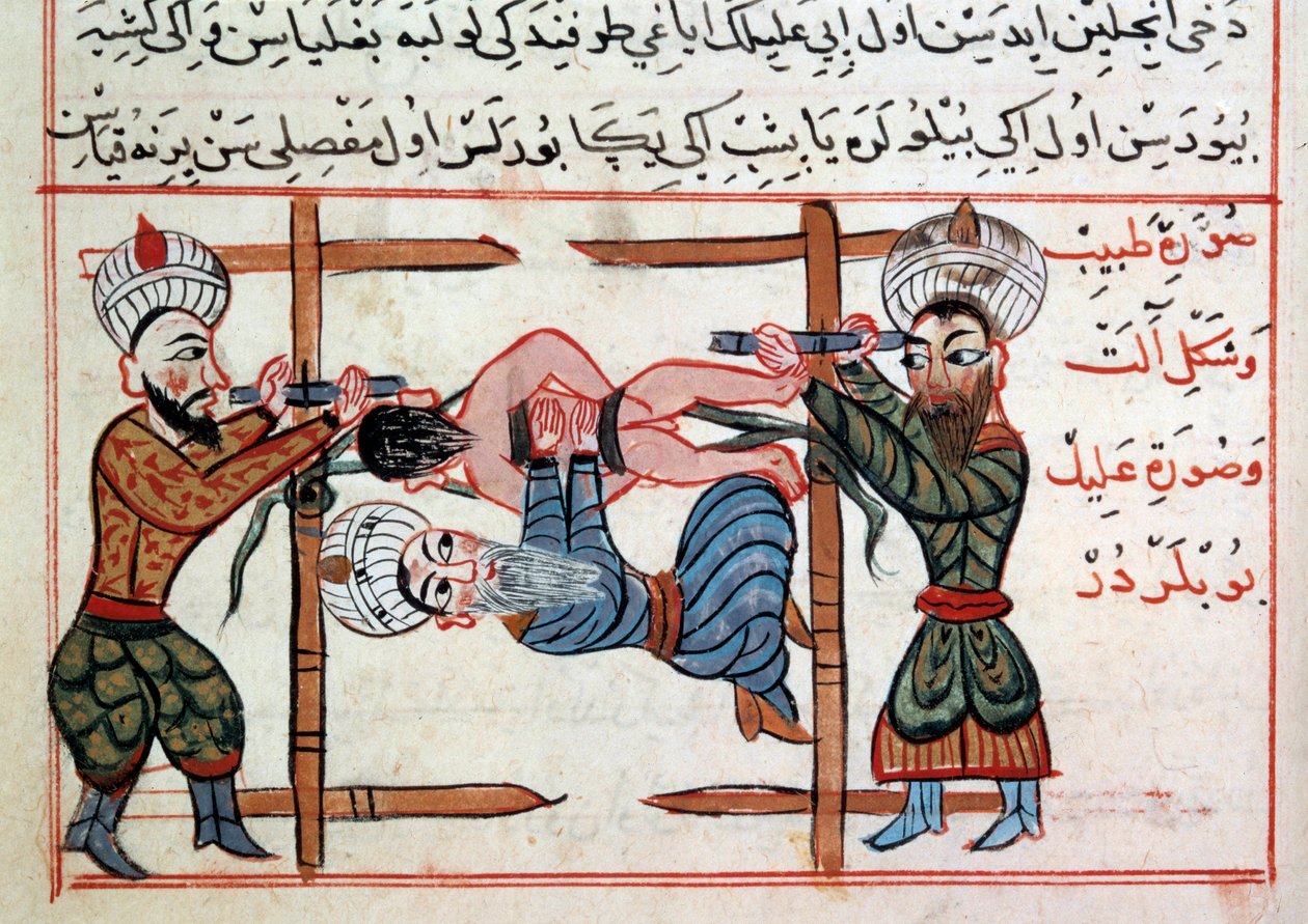 الحد من الكسر. صورة مصغرة من علاج الطب التركي لشرف الدين بواسطة المدرسة العثمانية