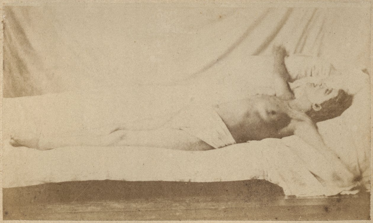 الصرع الهستيري ، الهجوم ، الصلب ، اللوحة السادسة من "Iconographie Photographique de La Salpetriere" بورنفيل و ب. ريجنارد ، باريس ، 1876 (طبعة زيلية) بواسطة بول ريجنارد