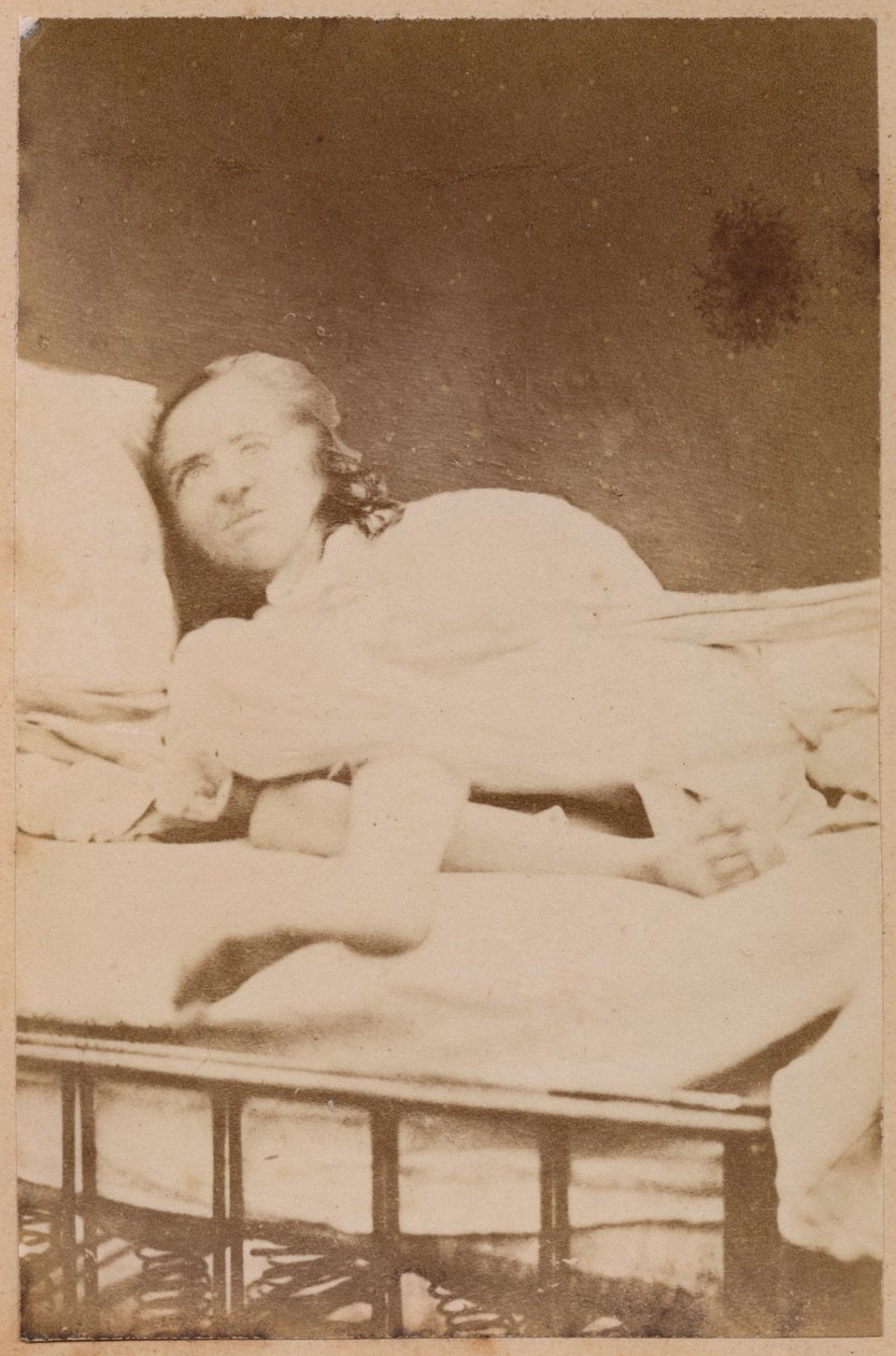 الصرع الهستيري ، الالتواءات ، اللوحة الثامنة والثلاثون من "Iconographie Photographique de La Salpetriere" بورنفيل و ب. ريجنارد ، باريس ، 1876 (طبعة زيلية) بواسطة بول ريجنارد