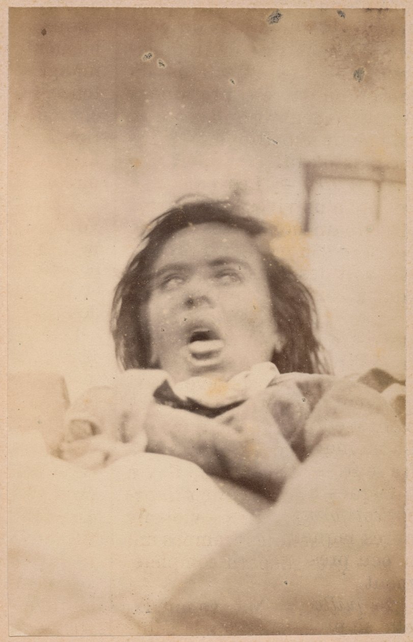 الصرع الهستيري ، الهلوسة ، الكرب ، اللوحة التاسعة والعشرون من `` Iconographie Photographique de La Salpetriere &39;&39; من بورنفيل و ب. ريجنارد ، باريس ، 1876 (طبعة زيلية) بواسطة بول ريجنارد
