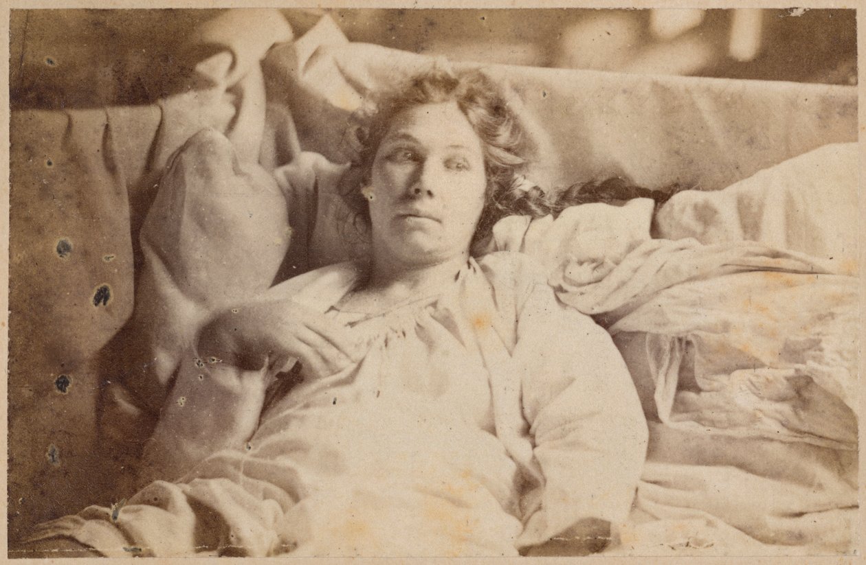 الصرع الهستيري ، المرحلة النهائية ، الهذيان الكئيب ، رسم توضيحي من "Iconographie Photographique de La Salpetriere" بقلم بورنفيل وآخرون ريجنارد ، اللوحة التاسعة عشرة ، باريس ، 1876 (طبعة زخرفية) بواسطة بول ريجنارد