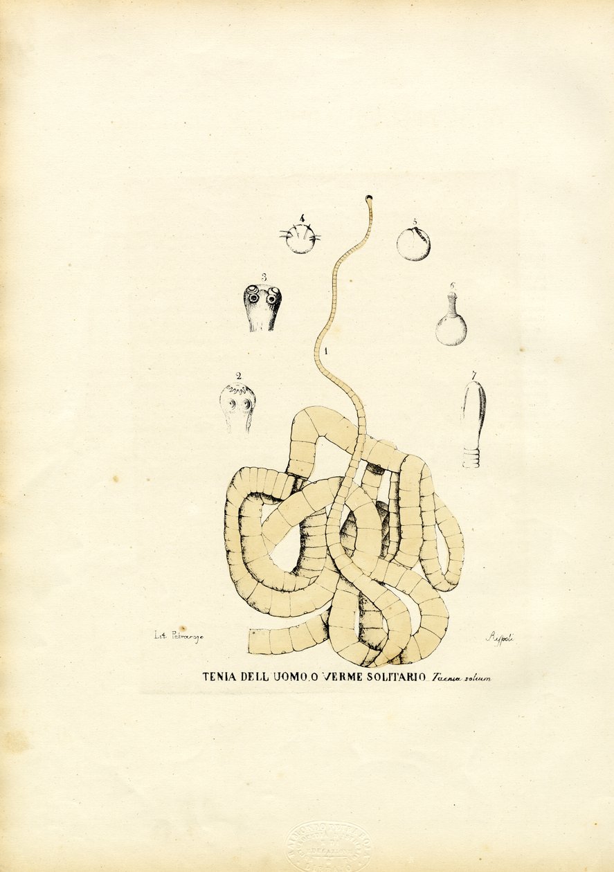 دودة الشريط ، 1863-1879 بواسطة رايموندو بيترارويا
